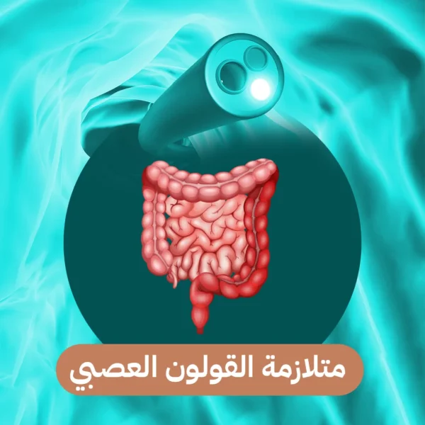 اسباب القولون العصبي 