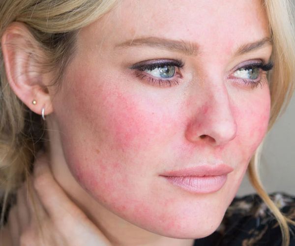 الفوائد الصحية للمغنيسيوم جلايسينيت