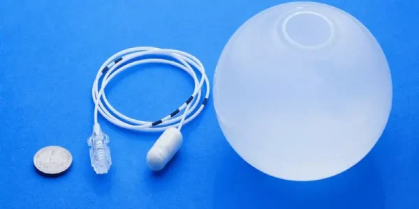 بالون المعدة لإنقاص الوزن من عيادات دكتور فهد ابراهيم