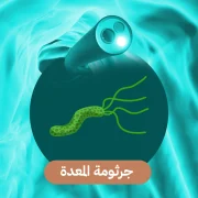 تشخيص وعلاج جرثومة المعدة من عيادات دكتور فهد الابراهيم